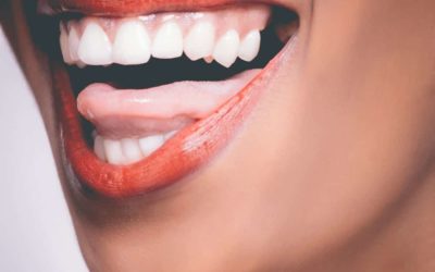 Astuces 100% naturelles pour prendre soin de ses dents